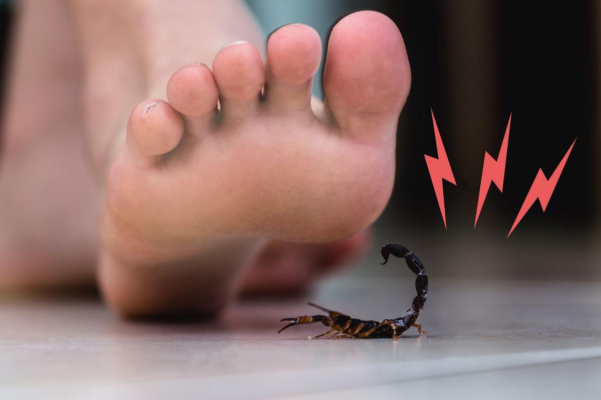 Weder Wespe noch Mücke: Der Stich dieses Tieres ist der gefürchtetste des Sommers – wie erkennt man ihn?
